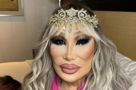 She Was a TV Icon Everyone Admired: Can You Recognize Her Before The Surgery?