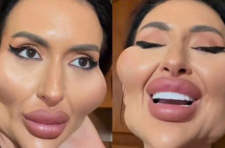 Woman with Oversized Cheekbones Gets a Butt Lift!: Her Mom Loves the Results!
