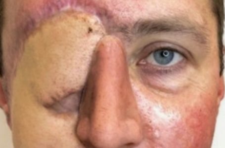 After Losing an Eye in a Car Accident, This Man Let a Tattoo Artist Redesign His Face!: The Results Are Beyond Incredible!