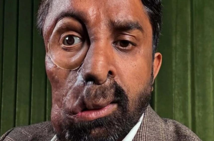 Man Refused Service Over Rare Condition!: What Happened Next Sparked Outrage Online!