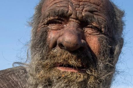 He Lived 60 Years Without a Bath!: What He Looked Like Will Leave You Speechless!