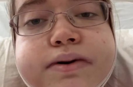 She Went 24 Hours For Jaw Surgery And Came Back Looking Unrecognizable: Her Pics!