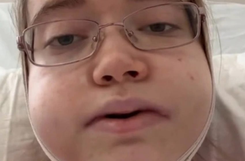 She Went 24 Hours For Jaw Surgery And Came Back Looking Unrecognizable: Her Pics!