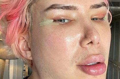 After $700K of Surgery, “She” Is De-Transitioning Again!: See the Surprising Before & After