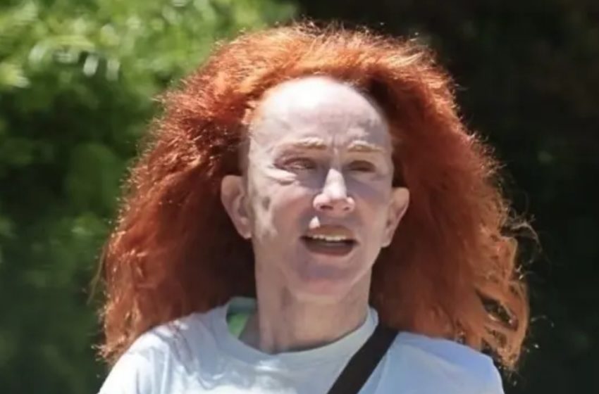 Once a Scandalous Star!: Now Almost Unrecognizable After Years of Surgery