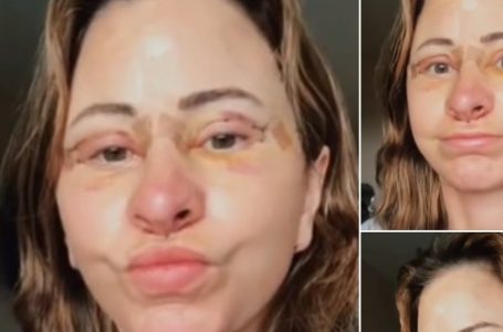 Woman Spends $14K on Facelift, Sells Home, and Embraces Van Life After Stunning Transformation!