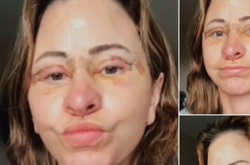 Woman Spends $14K on Facelift, Sells Home, and Embraces Van Life After Stunning Transformation!
