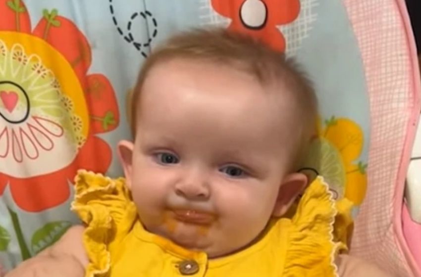 Baby Hulk” Newborn Who Defied the Odds Looks Completely Different Today!: See The Photos!