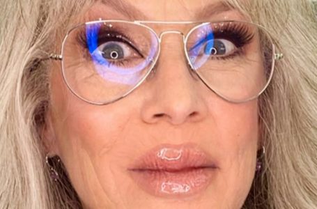 Hollywood Legend Surprises Fans with Dramatically Over-Plumped Lips and Bold New Look!