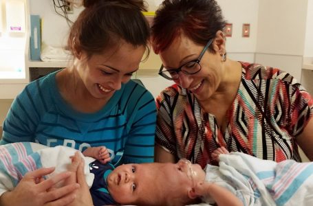 From Impossible Odds to a Miracle: Twin Boys Conjoined at the Head Finally Looked Into Each Other’s Eyes!