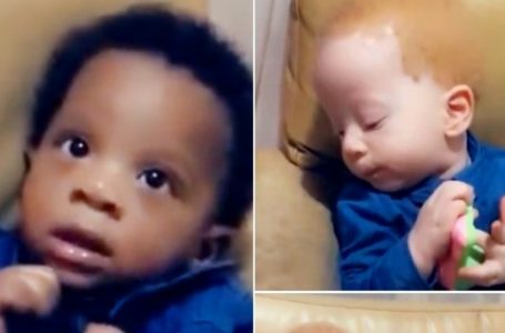 Unusual Twins Who Stunned the World!: See How They’ve Grown Up!