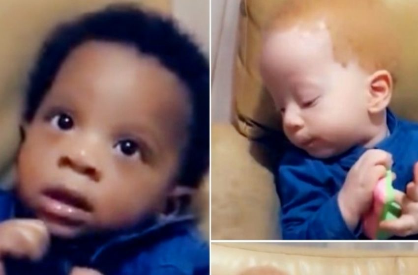  Unusual Twins Who Stunned the World!: See How They’ve Grown Up!