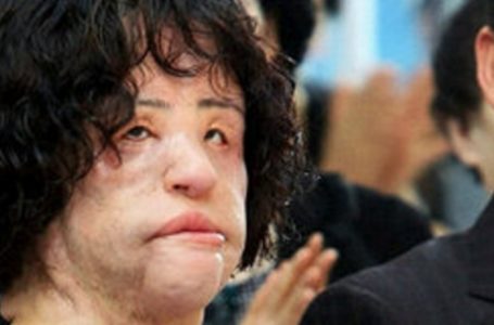 Hang Mioku’s Surprising Transformation: Beauty Quest Turns Into Nightmare !