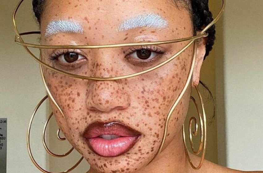 How Freckles Helped Her Shine as a Model!: See More Photos!