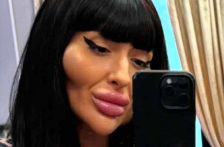 The Girl with Striking Cheekbones Shows Off Her Partner!: Fans Ask, “How Much Did She Pay Him?”