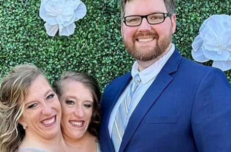 Hensel Twins Welcome a Child Amid Skepticism: Is Pregnancy Even Possible?