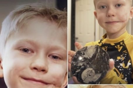 Brave Boy Who Saved His Sibling From a Dog Attack Calls His Scar a Badge of Honor!: Find Out The Details!
