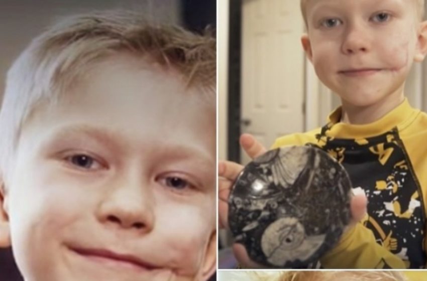 Brave Boy Who Saved His Sibling From a Dog Attack Calls His Scar a Badge of Honor!: Find Out The Details!