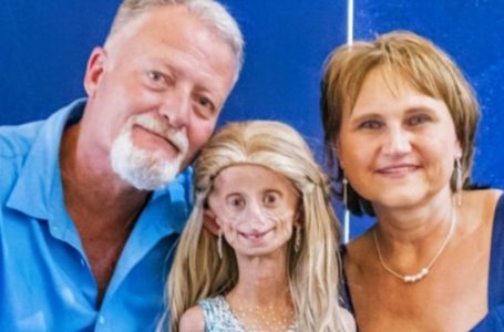 Teen Who Aged 8 Times Faster Shares Heartfelt Message That’s Inspiring the World!: Find Out The Details!